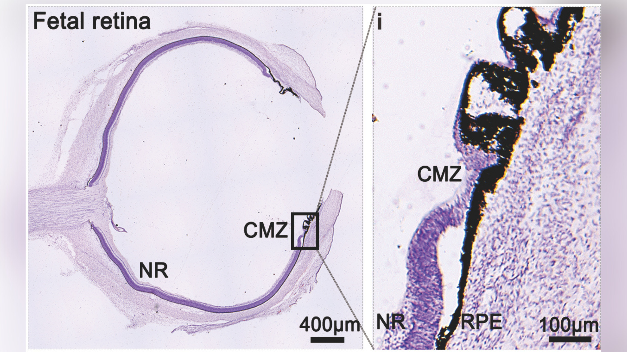 An image of a tissue stain of the fetal retina showing the stem cells within it.