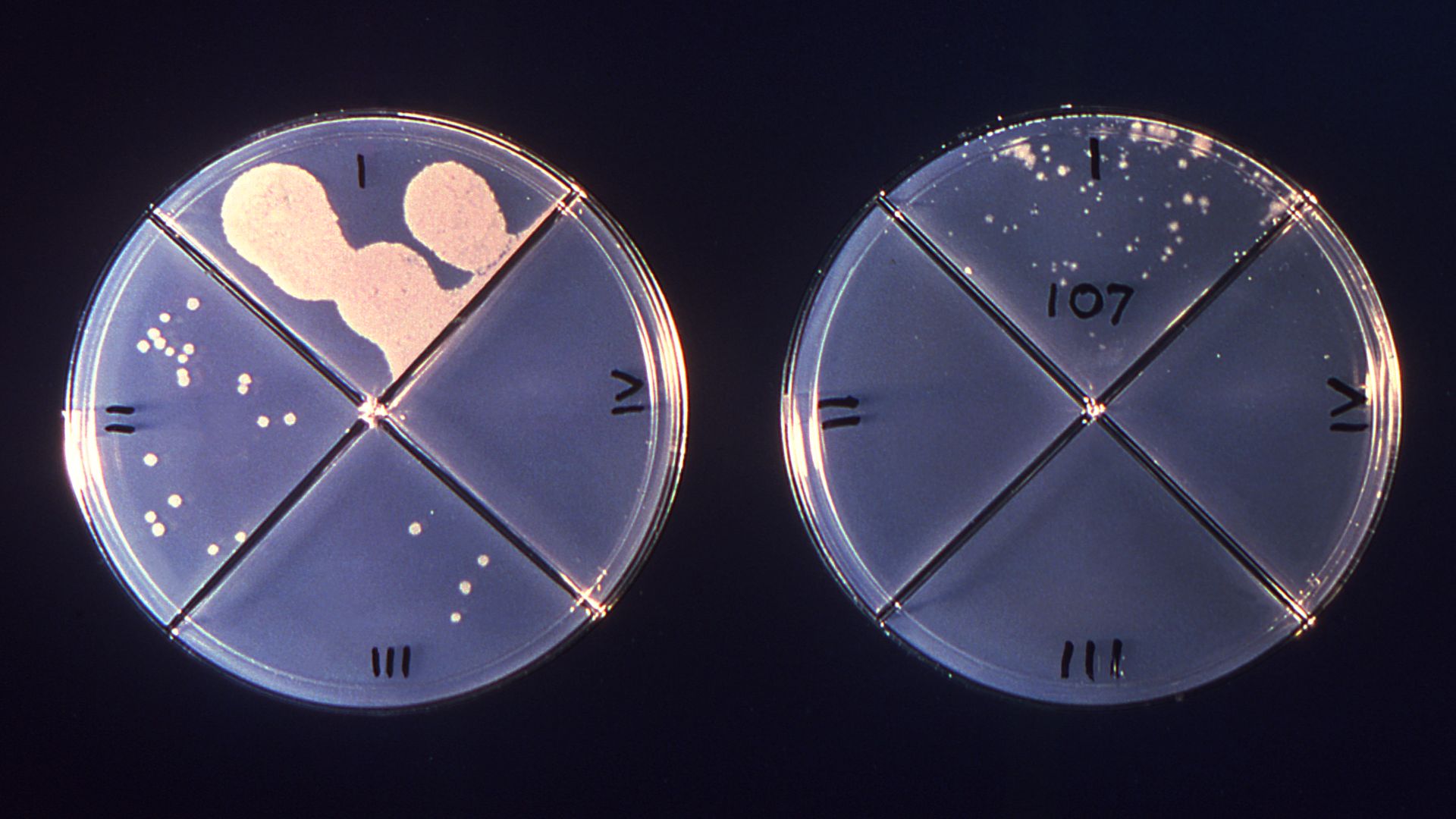 photo of two circular petri dishes with colonies of mycobacterium tuberculosis growing on them