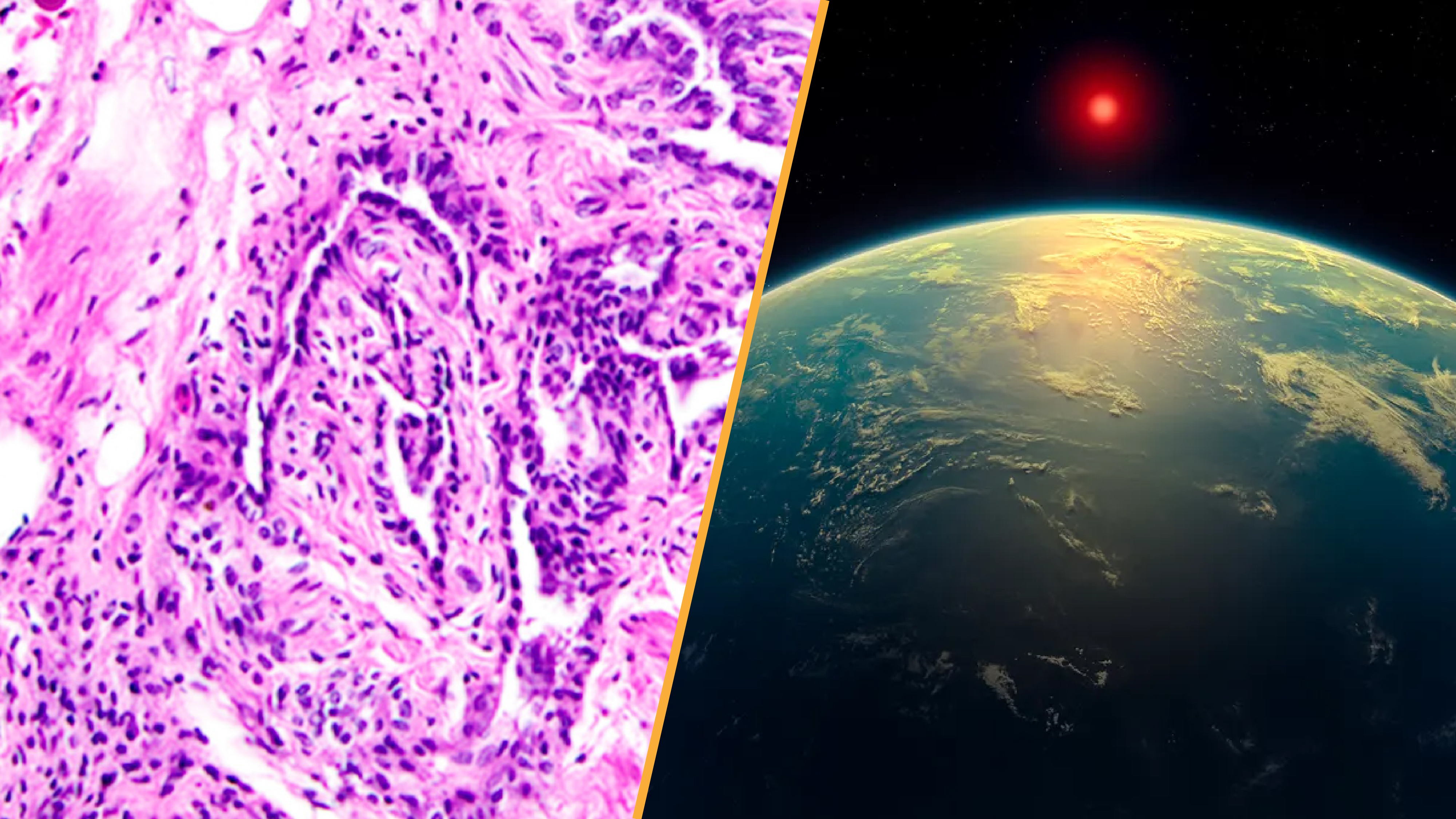 A two paneled image. On the left, a microscope image of the rete ovarii. On the right, an illustration of exoplanet k2-18b
