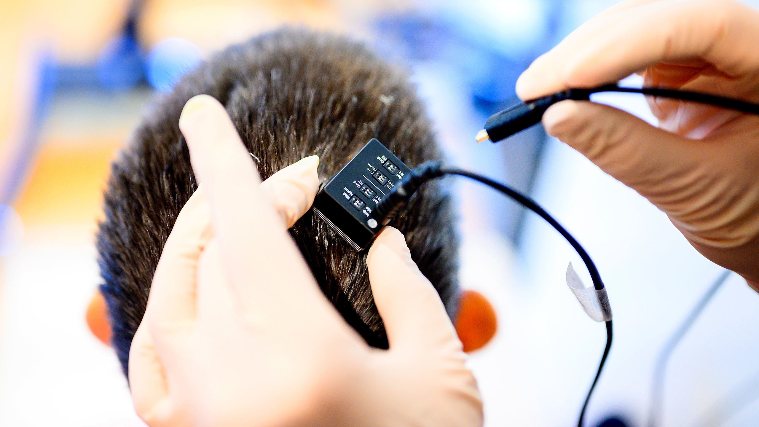 A photo of researchers connecting a person&#039;s brain implant to a voice synthesizer computer. 